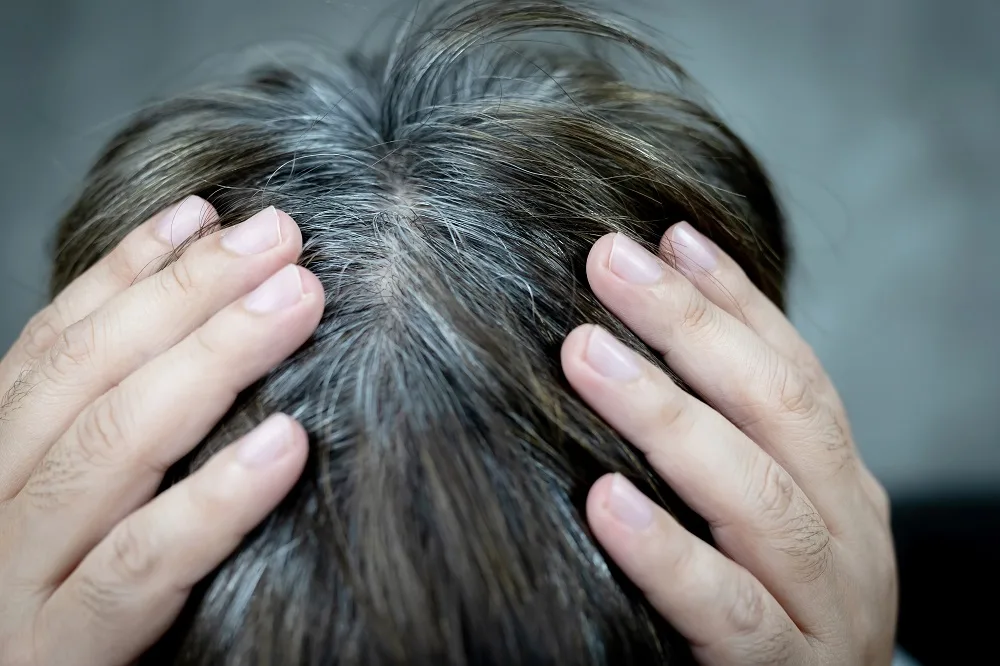 stress can cause premature hair greying