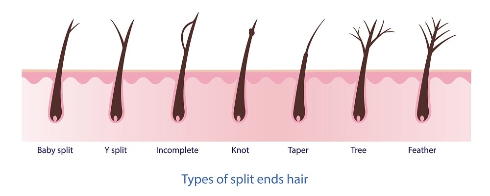 types of split ends