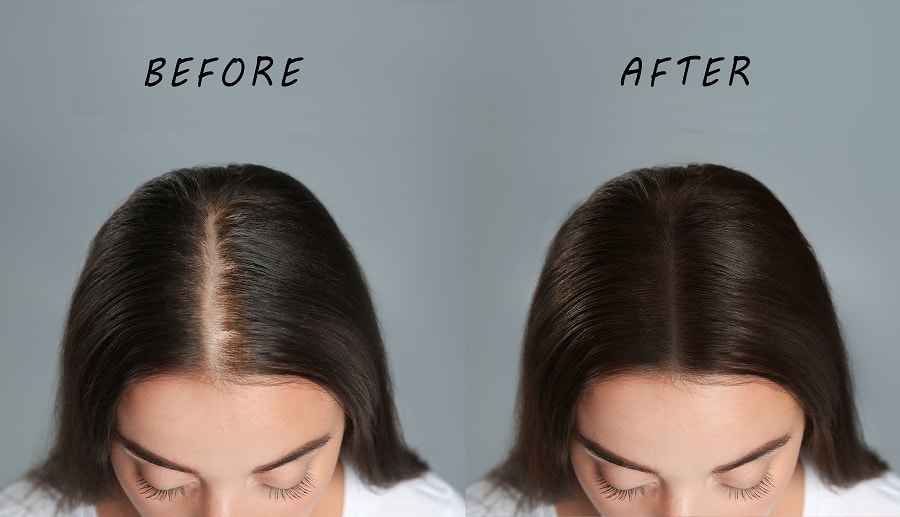 ways to fix a widening hair parting